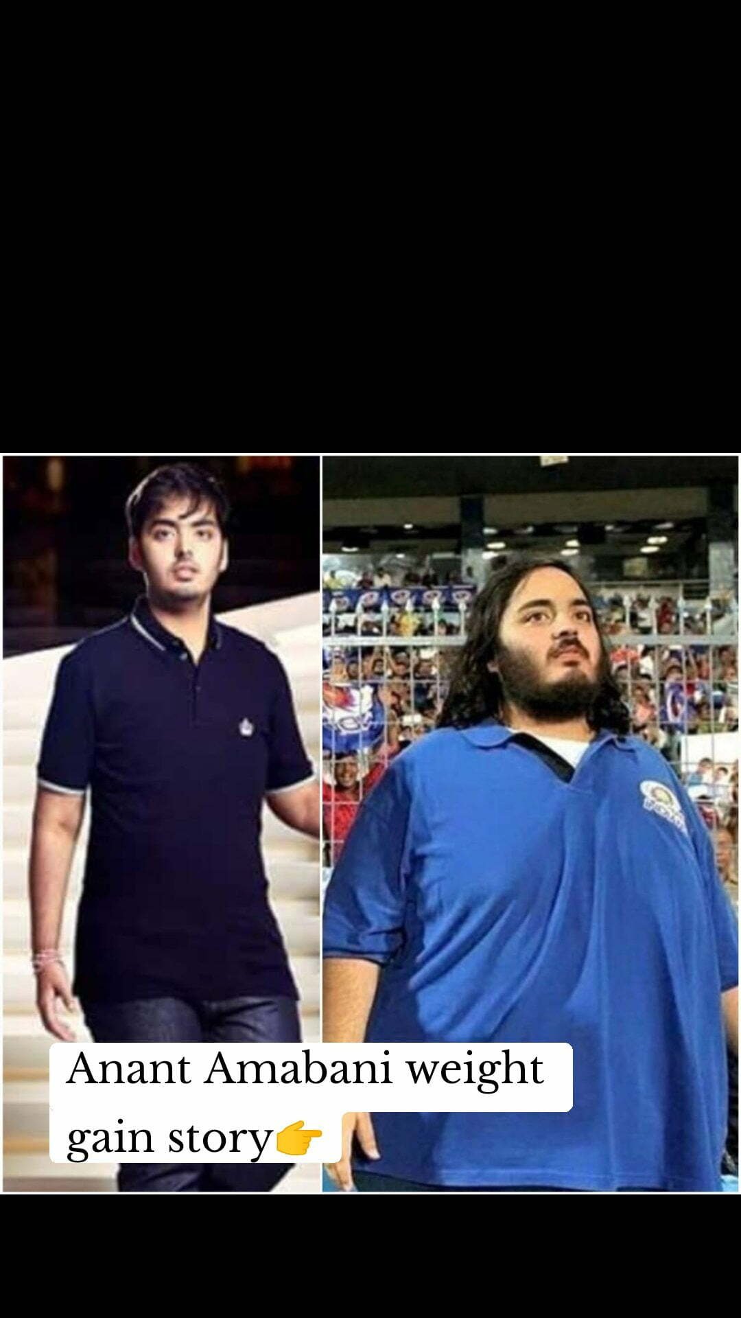 Anant Ambani Weight gain story