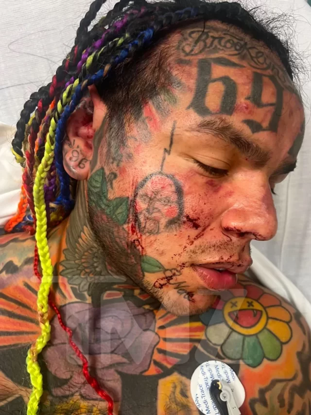TEKASHI 6IX9INE BRUTALLY ATTACKED IN GYM: Video, images